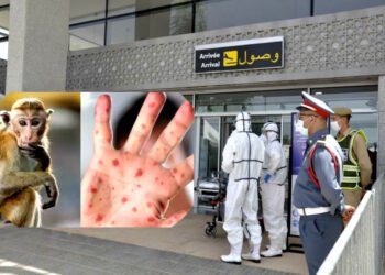 جدري القردة.. فرض المراقبة الحدودية بالمغرب