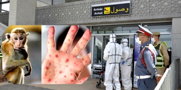 جدري القردة.. فرض المراقبة الحدودية بالمغرب