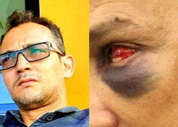 تفاصيل تبادل الضرب بين مدير مدرسة ومستشار جماعي في طنجة