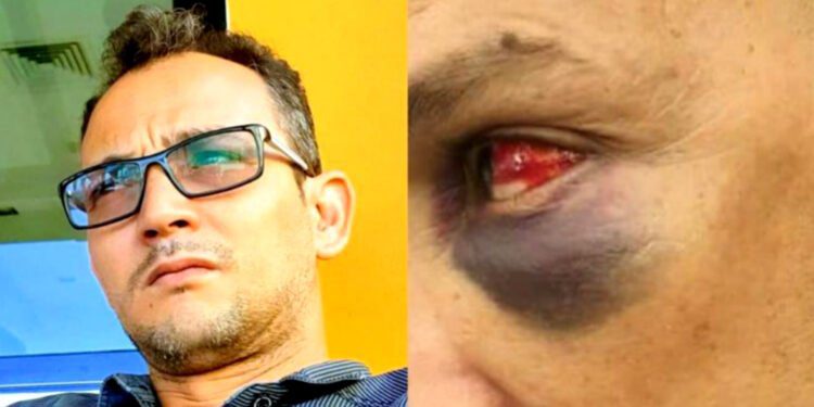 تفاصيل تبادل الضرب بين مدير مدرسة ومستشار جماعي في طنجة