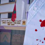 إصابة أستاذ بجروج