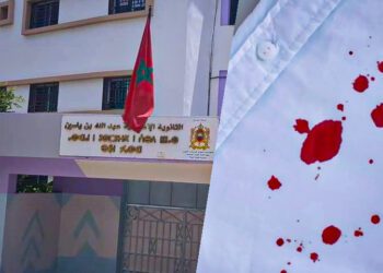 إصابة أستاذ بجروج