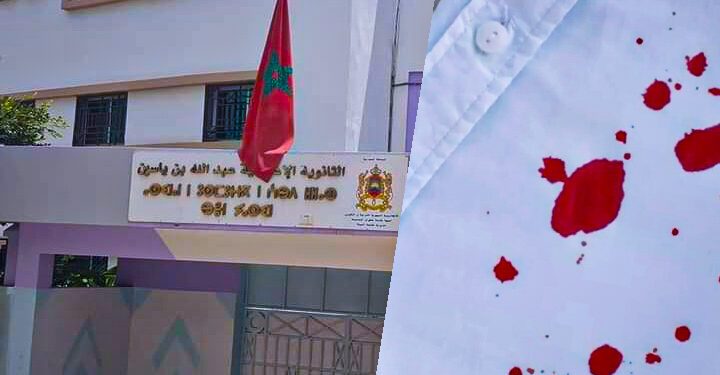 إصابة أستاذ بجروج