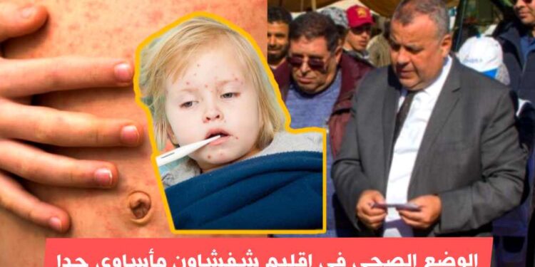 مرض بوحمرون