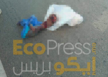 أطراف بشرية مقطعة .. حادث غامض و لغز محير