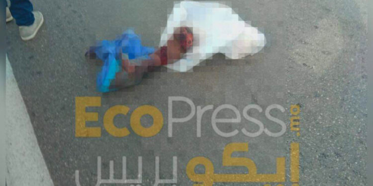 أطراف بشرية مقطعة .. حادث غامض و لغز محير