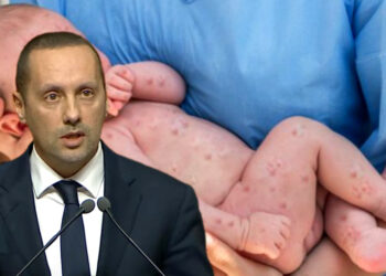 حصيلة مقلقة لمرض بوحمرون بالمغرب: وزير الصحة يكشف عن 107 حالات وفاة وأسباب الانتشار