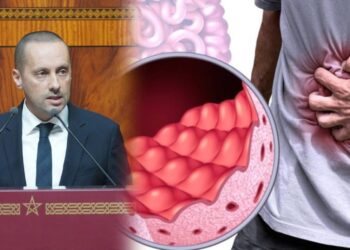 المواد الغذائية الخالية من الغلوتين