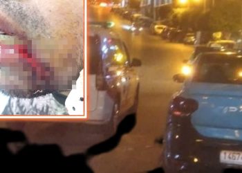 شخص يهاجم سائق سيارة أجرة بطنحة و يشوه وجهه في اعتداء خطير