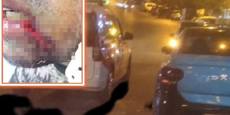 شخص يهاجم سائق سيارة أجرة بطنحة و يشوه وجهه في اعتداء خطير