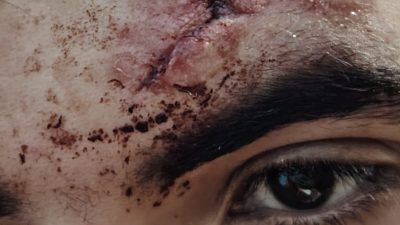صحفي بطنجة يتعرض "لكريساج" قرب مقر مقاطعة طنجة المدينة 