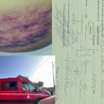 21 يوماً عجزاً طبياً.. والاعتداء على امرأة باكزناية موثق بالفيديو دون اعتقال المعتدي