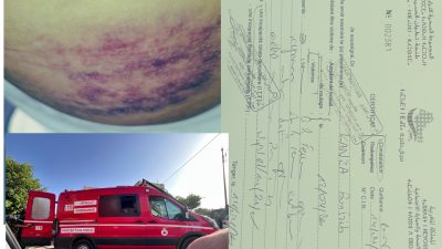 21 يوماً عجزاً طبياً.. والاعتداء على امرأة باكزناية موثق بالفيديو دون اعتقال المعتدي